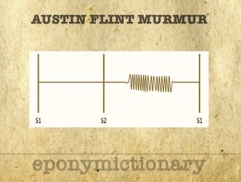 Austin Flint Murmur 340