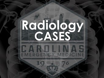 CMC radiology Cases 340 logo