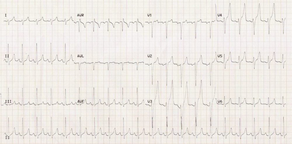 ECG 012 Metabolic Mayhem 002