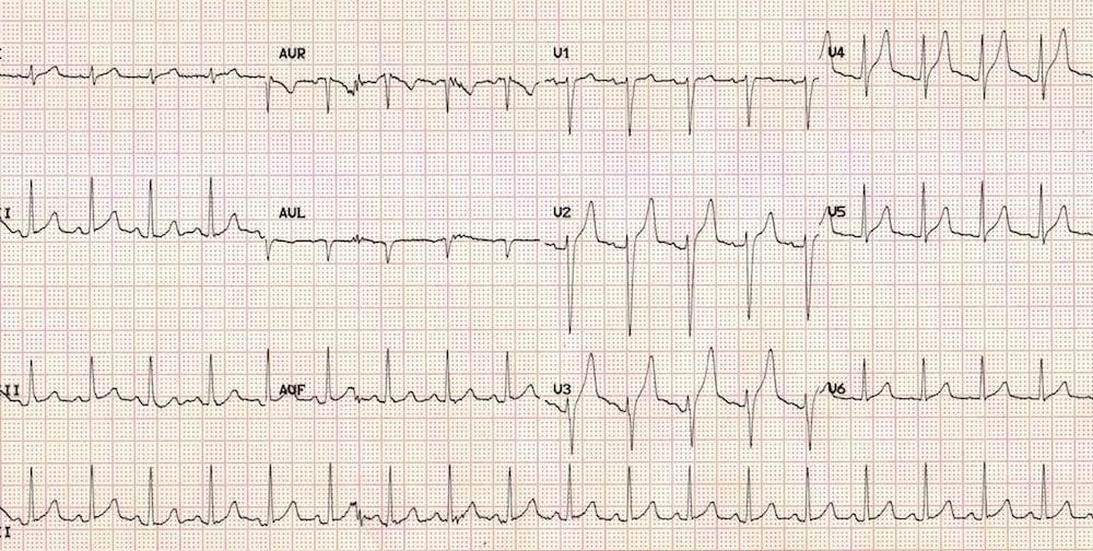 ECG 012 Metabolic Mayhem 003