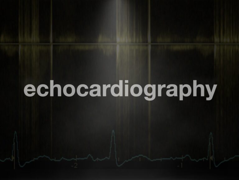 Echocardiography LITFL ECHO