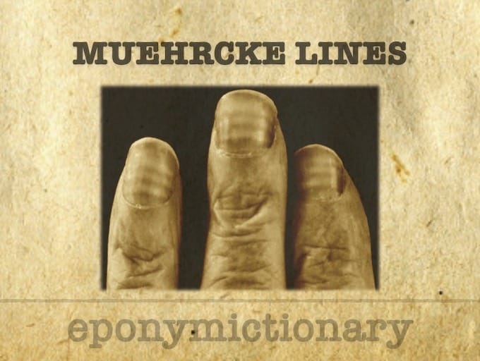 MUEHRCKE LINES 680
