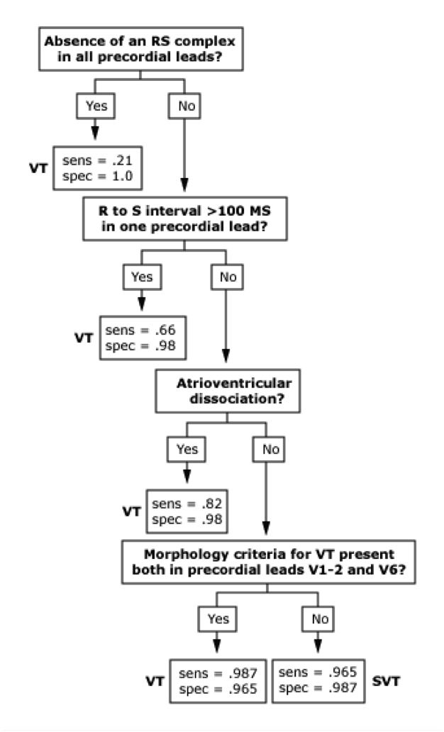 Brugada criteria VT diagnosis