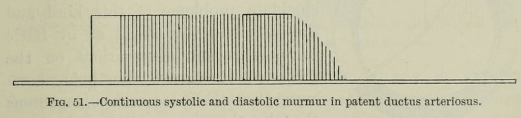 Gibson Murmur PDA 1906 fig 51